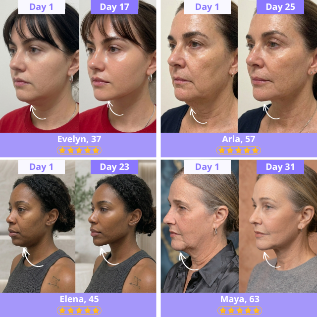 NORA Face Shaper